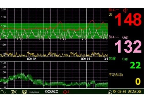 Kardiotokograf (CTG) L8, slika 5